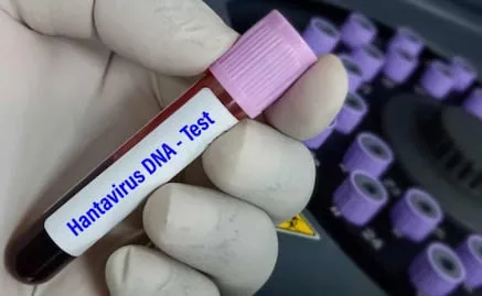 Confirman seis casos de hantavirus tras brote en crucero; hay tres muertos