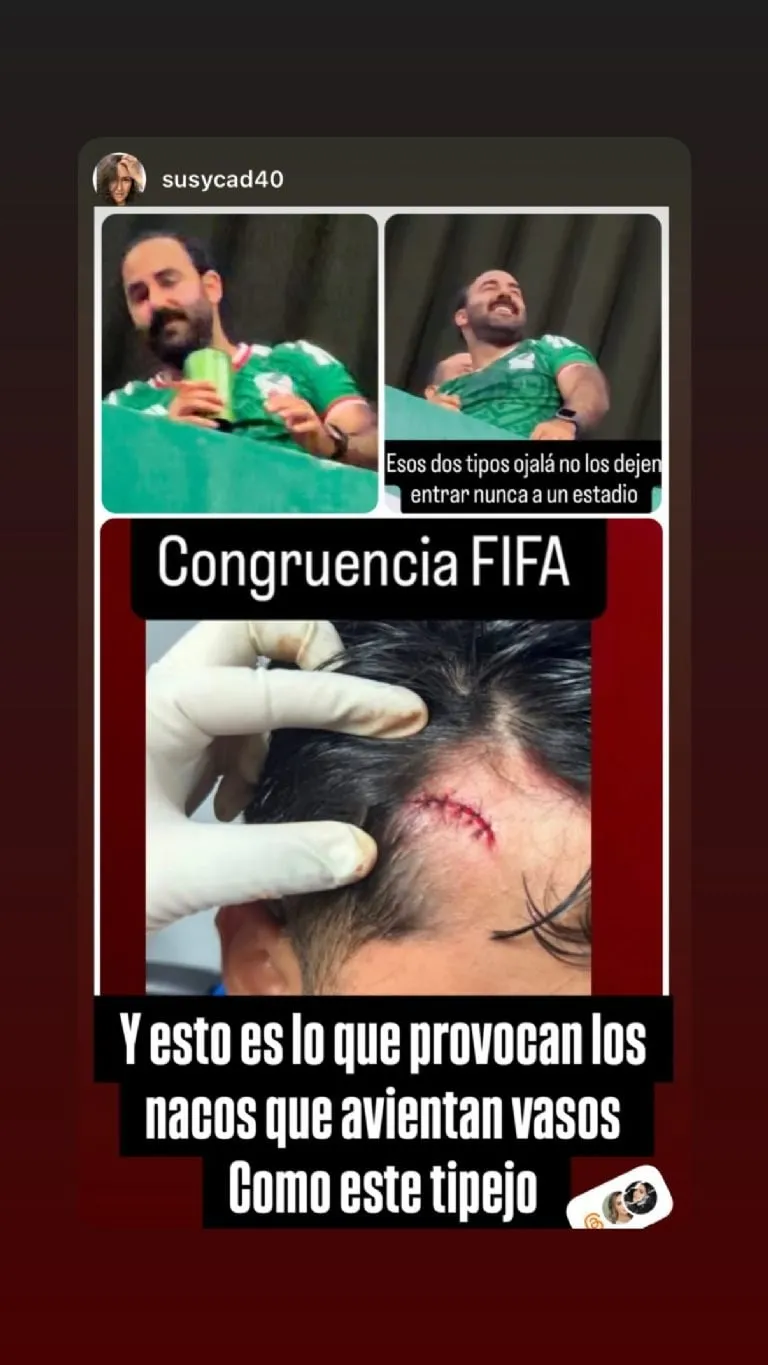 Esposa de Raúl Jiménez denuncia que familiar de un jugador sufrió descalabro con un vaso de cerveza en el México vs Chequia