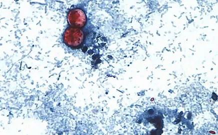 Inspectores de la FDA van a planta de Taylor Farms, en México; fue vinculada a brote de ciclosporiasis